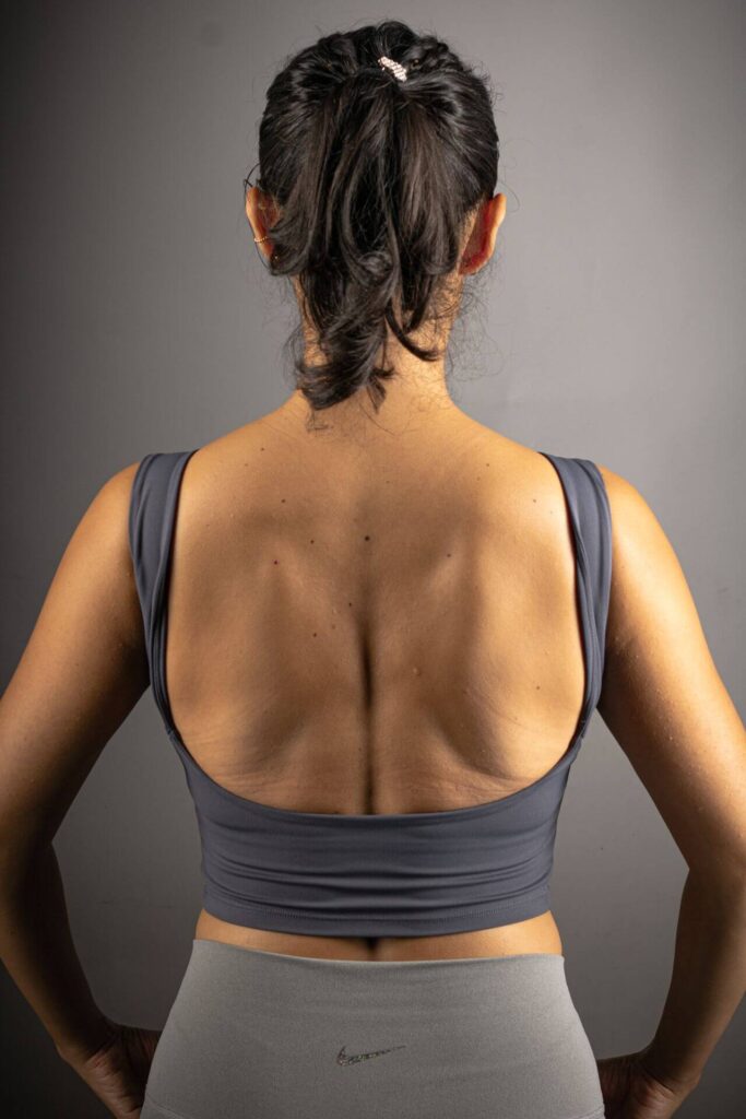 Back view of a woman showing posture after posture corrector chiropractic treatment